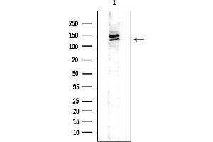 Western blot analysis of lysates from EC304 cells, using HCN4 Mouse Monoclonal Antibody at 1/1000 dilution.