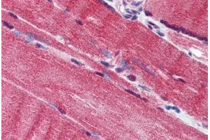 Human Skeletal Muscle (formalin-fixed, paraffin-embedded) stained with IQWD1 antibody ABIN293866 at 10 ug/ml followed by biotinylated goat anti-rabbit IgG secondary antibody ABIN481713, alkaline phosphatase-streptavidin and chromogen. (DCAF6 antibody  (AA 800-850))