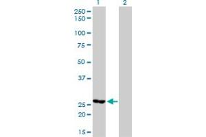 Western Blot analysis of MTHFD2 expression in transfected 293T cell line by MTHFD2 monoclonal antibody (M01), clone 4G7-2G3. (MTHFD2 antibody  (AA 16-344))
