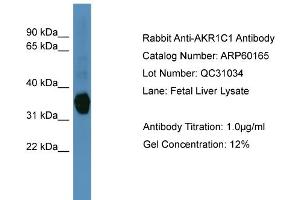 WB Suggested Anti-AKR1C1  Antibody Titration: 0. (AKR1C1 antibody  (N-Term))