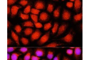 Immunofluorescence analysis of Hela cells using DNAJB14 Polyclonal Antibody at dilution of 1:100 (40x lens). (DNAJB14 antibody)