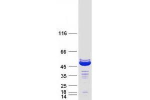 Homer Homolog 3 (Drosophila) (HOMER3) (Transcript Variant 2) protein (Myc-DYKDDDDK Tag)