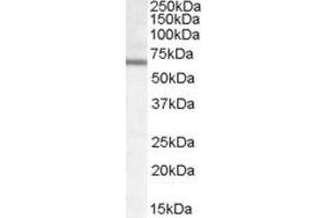 Western Blotting (WB) image for anti-Dachshund 2 (DACH2) (AA 169-181) antibody (ABIN303849) (DACH2 antibody  (AA 169-181))