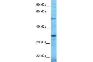 Host:  Rabbit  Target Name:  TULP2  Sample Type:  OVCAR-3 Whole Cell lysates  Antibody Dilution:  1. (TULP2 antibody  (C-Term))