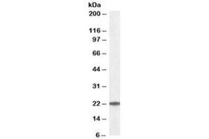 Western blot testing of K562 lysate with UBE2T antibody at 0. (Ube2t antibody)