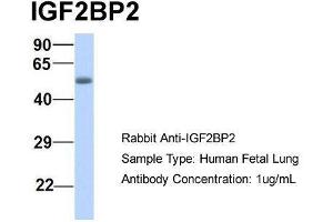 Host:  Rabbit  Target Name:  IGF2BP2  Sample Type:  Human Fetal Lung  Antibody Dilution:  1. (IGF2BP2 antibody  (Middle Region))