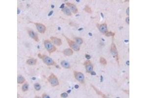 Figure. (Calreticulin antibody  (AA 199-308))