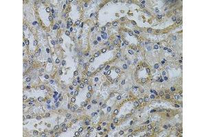 Immunohistochemistry of paraffin-embedded Mouse kidney using SERPINE2 Polyclonal Antibody at dilution of 1:100 (40x lens). (SERPINE2 antibody)