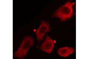 ABIN6268919 staining HuvEc cells by IF/ICC. (Caveolin-1 antibody  (C-Term))