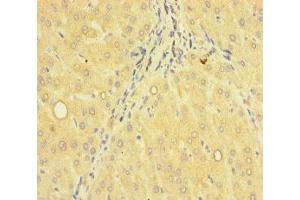 Immunohistochemistry of paraffin-embedded human liver tissue using ABIN7143108 at dilution of 1:100 (ACTR5 antibody  (AA 183-285))