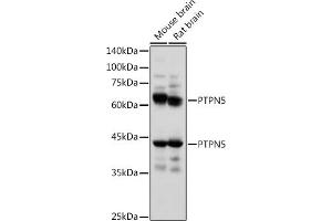 Western blot analysis of extracts of various cell lines, using PTPN5 antibody (ABIN7269705) at 1:1000 dilution. (PTPN5 antibody  (AA 360-490))