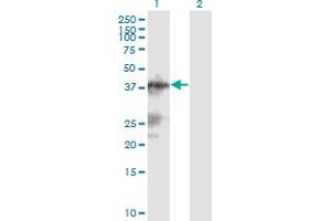 Western Blot analysis of C13orf31 expression in transfected 293T cell line by C13orf31 monoclonal antibody (M04), clone 2A1. (LACC1 antibody  (AA 1-430))