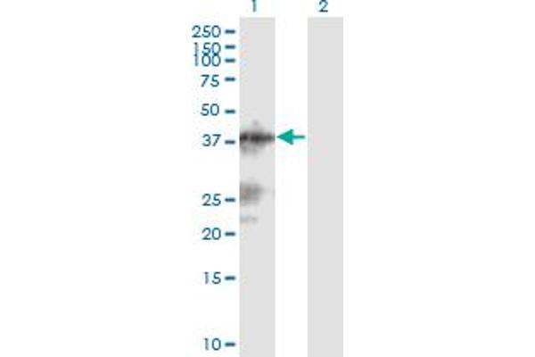 LACC1 anticorps  (AA 1-430)