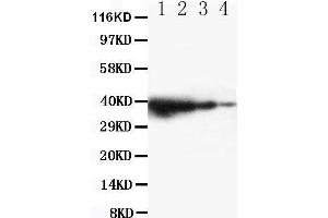 Western Blotting (WB) image for anti-Toll-Like Receptor Adaptor Molecule 1 (TICAM1) (AA 693-708), (C-Term) antibody (ABIN3042956) (TICAM1 antibody  (C-Term))