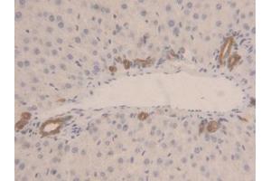 Immunohistochemistry (IHC) image for anti-Lactate Dehydrogenase B (LDHB) (AA 1-334) antibody (ABIN7433972)