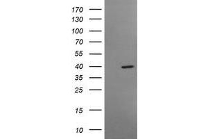 Image no. 1 for anti-Musashi Homolog 1 (Drosophila) (MSI1) antibody (ABIN1499574) (MSI1 antibody)