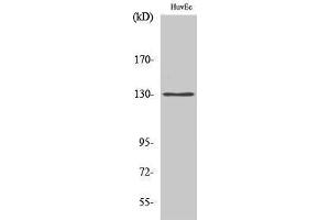 Western Blotting (WB) image for anti-5-Azacytidine Induced 1 (AZI1) (Internal Region) antibody (ABIN3183458)