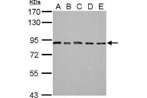WB Image MAD1 antibody detects MAD1L1 protein by Western blot analysis. (PSMD14 antibody  (Center))