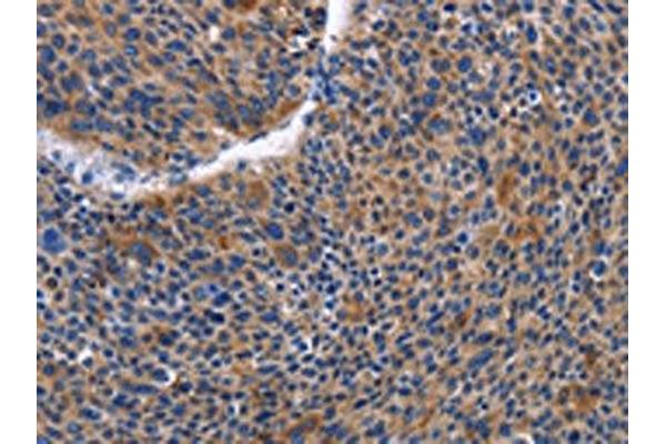IGSF1 antibody