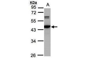 WB Image Sample(30 ug whole cell lysate) A:293T 10% SDS PAGE antibody diluted at 1:2000 (CAMK4 antibody)