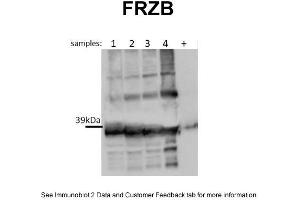WB Suggested Anti-FRZB Antibody Titration: 0. (FRZB antibody  (N-Term))