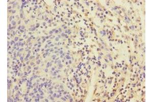Immunohistochemistry (IHC) image for anti-Eukaryotic Translation Initiation Factor 4E Family Member 2 (EIF4E2) (AA 1-240) antibody (ABIN7152192)