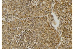 ABIN6279828 at 1/100 staining Human pancreas tissue by IHC-P. (CXCL11 antibody  (Internal Region))