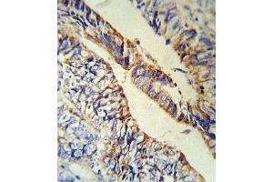 Immunohistochemistry (Paraffin-embedded Sections) (IHC (p)) image for anti-Proprotein Convertase Subtilisin/kexin Type 9 (PCSK9) (AA 479-508), (C-Term) antibody (ABIN391505)