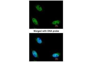 ICC/IF Image Immunofluorescence analysis of paraformaldehyde-fixed HeLa, using NSUN6, antibody at 1:200 dilution. (NSUN6 antibody  (Center))