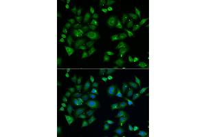 Immunofluorescence analysis of A549 cell using EPM2A antibody. (EPM2A antibody)