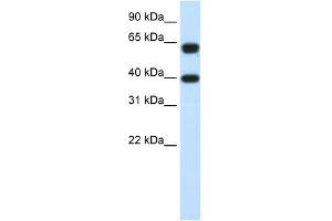 NXF3 antibody used at 1. (NXF3 antibody  (C-Term))