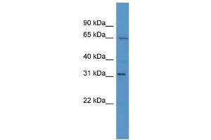 WB Suggested Anti-Hoxc12 Antibody Titration:  0.