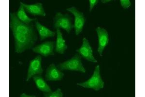 Immunofluorescence analysis of A549 cells using CDC5L Polyclonal Antibody (CDC5L antibody)