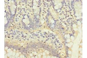 Immunohistochemistry of paraffin-embedded human small intestine tissue using ABIN7175029 at dilution of 1:100 (C5ORF22 antibody  (AA 101-420))