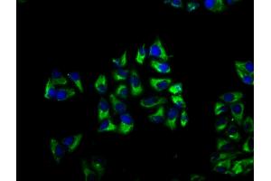 Immunofluorescence staining of Hela cells with ABIN7145792 at 1:66, counter-stained with DAPI. (BROX antibody  (AA 288-409))