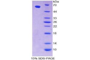 SDS-PAGE (SDS) image for POU Domain, Class 2, Transcription Factor 1 (POU2F1) (AA 128-391) protein (His tag,GST tag) (ABIN2123417) (POU2F1 Protein (AA 128-391) (His tag,GST tag))