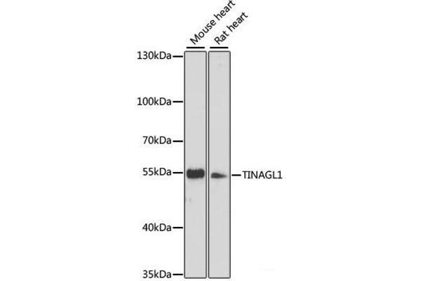 TINAGL1 抗体