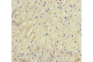 Immunohistochemistry of paraffin-embedded human heart tissue using ABIN7165198 at dilution of 1:100