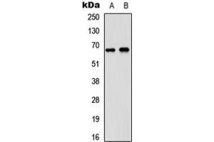 Western blot analysis of DDX5 expression in A431 (A), SHSY5Y (B) whole cell lysates. (DDX5 antibody  (C-Term))