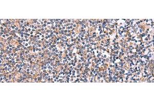 Immunohistochemistry of paraffin-embedded Human tonsil tissue using INPP5B Polyclonal Antibody at dilution of 1:40(x200) (INPP5B antibody)