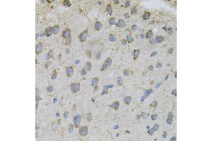 Immunohistochemistry of paraffin-embedded mouse brain using DBI Antibody. (Diazepam Binding Inhibitor antibody)