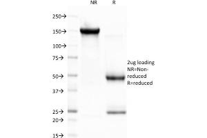 SDS-PAGE Analysis Purified CELA3B Monoclonal Antibody (CELA3B/1757).