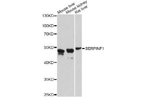 Western blot analysis of extracts of various cell lines, using SERPINF1 antibody (ABIN4905126) at 1:3000 dilution.
