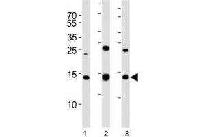 Western blot analysis of lysate from (1) 293T, (2) HL-60, (3) Jurkat cell line using SUMO2 antibody. (SUMO2 antibody  (AA 63-93))