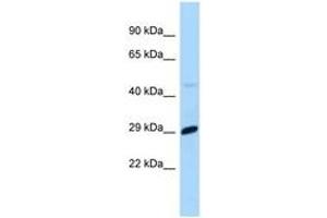 Image no. 1 for anti-MAX Dimerization Protein 1 (MXD1) (C-Term) antibody (ABIN6748028) (MXD1 antibody  (C-Term))