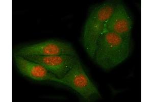 anti-Myc Proto-Oncogene protein (MYC) (AA 257-439) antibody