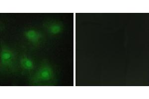 Peptide - +Western blot analysis of extracts from HUVEC cells, HepG2 cells and Jurkat cells, using CDK2 antibody. (CDK2 antibody  (Internal Region))