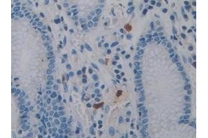 Detection of PTPRQ in Human Stomach Tissue using Polyclonal Antibody to Protein Tyrosine Phosphatase Receptor Type Q (PTPRQ)