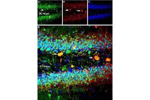 Expression of GPER in rat dentate gyrus - Immunohistochemical staining of rat hippocampal dentate gyrus using Anti-GPER (GPR30) Antibody (ABIN7043144, ABIN7044267 and ABIN7044268). (GPER antibody  (C-Term, Intracellular))