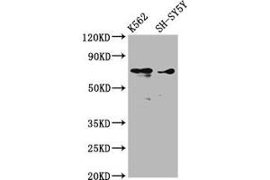 Western Blot Positive WB detected in: K562 whole cell lysate, SH-SY5Y whole cell lysate All lanes: ALOX12 antibody at 3. (ALOX12 antibody  (AA 508-658))